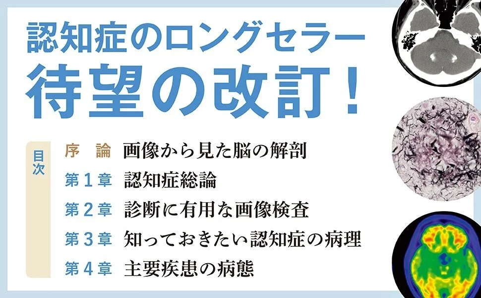 認知症イメージングテキスト 第2版 目次