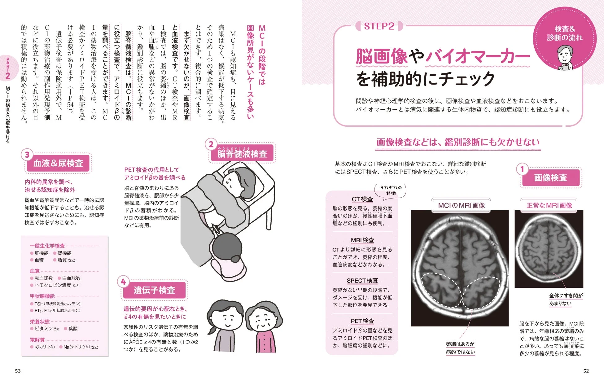MCIの検査と診断の流れ
